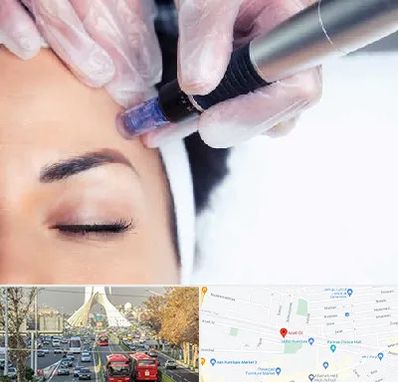 کلینیک مزوتراپی صورت در خیابان آزادی 