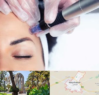 کلینیک مزوتراپی صورت در نیشابور