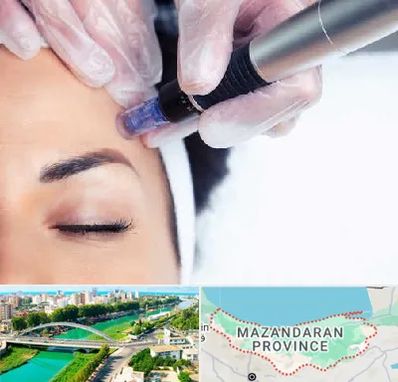 کلینیک مزوتراپی صورت در مازندران