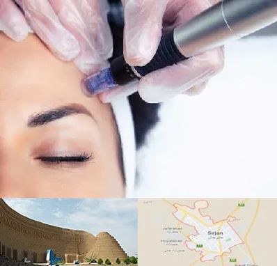 کلینیک مزوتراپی صورت در سیرجان