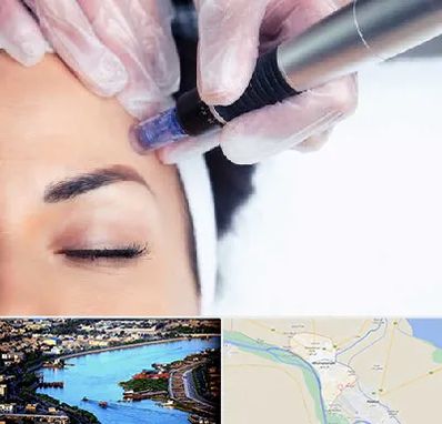کلینیک مزوتراپی صورت در خرمشهر
