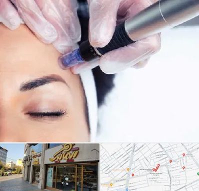 کلینیک مزوتراپی صورت در عطاران قم