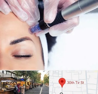 کلینیک مزوتراپی صورت در سی تیر