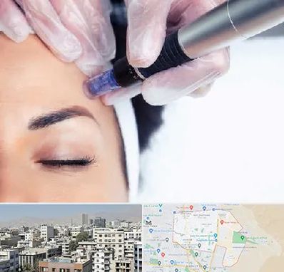 کلینیک مزوتراپی صورت در منطقه 14 تهران 