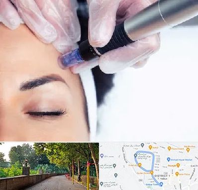 کلینیک مزوتراپی صورت در بلوار گیلان رشت