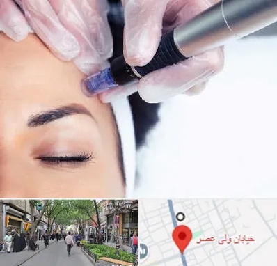 کلینیک مزوتراپی صورت در ولیعصر شهریار