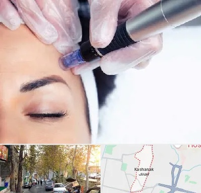 کلینیک مزوتراپی صورت در کاشانک