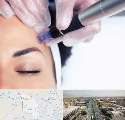 کلینیک مزوتراپی صورت در حصارک کرج