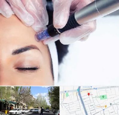 کلینیک مزوتراپی صورت در کوی فیروز تبریز