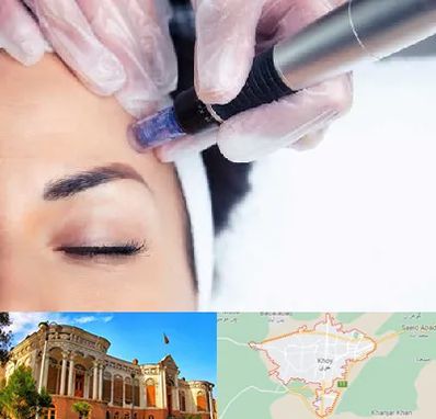 کلینیک مزوتراپی صورت در خوی