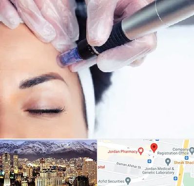 کلینیک مزوتراپی صورت در جردن 