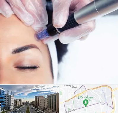 کلینیک مزوتراپی صورت در سعادت آباد 