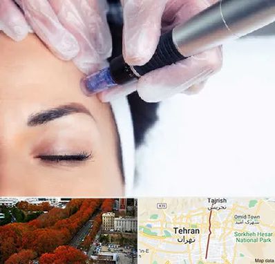 کلینیک مزوتراپی صورت در ولیعصر 