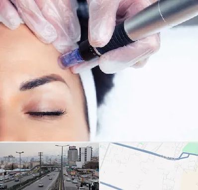 کلینیک مزوتراپی صورت در بلوار ارتش