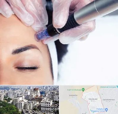 کلینیک مزوتراپی صورت در ولنجک 