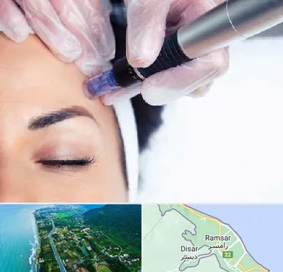 کلینیک مزوتراپی صورت در رامسر