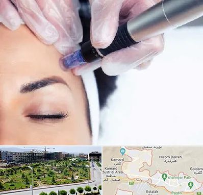 کلینیک مزوتراپی صورت در پردیس