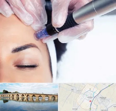 کلینیک مزوتراپی صورت در فلاورجان