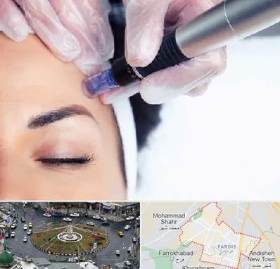 کلینیک مزوتراپی صورت در فردیس کرج 