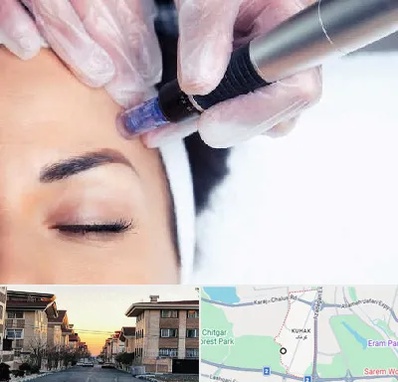 کلینیک مزوتراپی صورت در کوهک