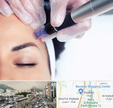 کلینیک مزوتراپی صورت در پونک 