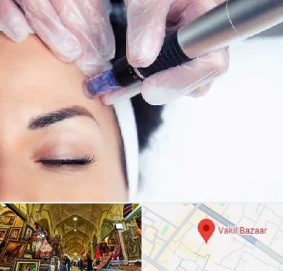 کلینیک مزوتراپی صورت در بازار وکیل شیراز