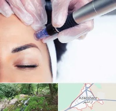 کلینیک مزوتراپی صورت در آزادشهر