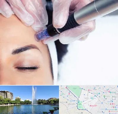 کلینیک مزوتراپی صورت در کوهسنگی مشهد