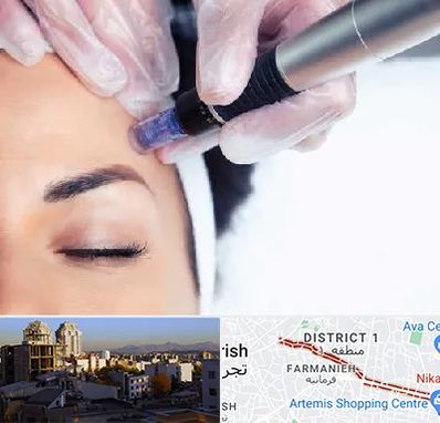 کلینیک مزوتراپی صورت در فرمانیه 