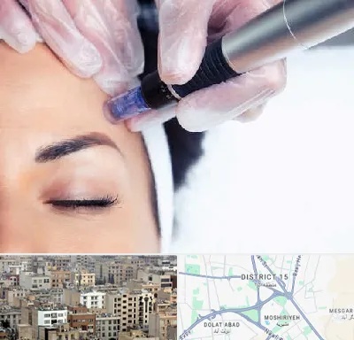 کلینیک مزوتراپی صورت در جنوب شرق تهران