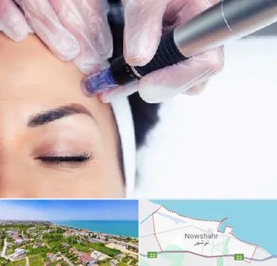 کلینیک مزوتراپی صورت در نوشهر
