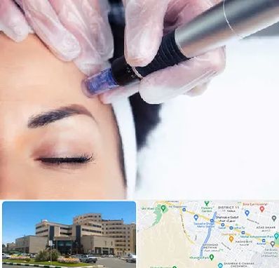 کلینیک مزوتراپی صورت در صیاد شیرازی مشهد