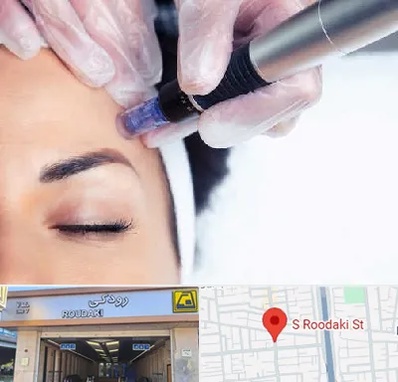 کلینیک مزوتراپی صورت در رودکی