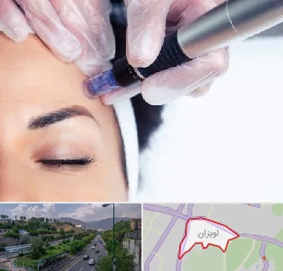 کلینیک مزوتراپی صورت در لویزان