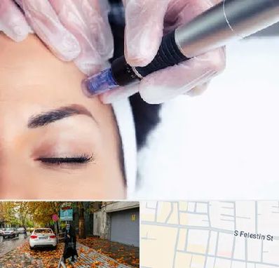 کلینیک مزوتراپی صورت در خیابان فلسطین