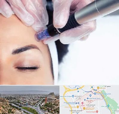 کلینیک مزوتراپی صورت در معالی آباد شیراز