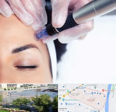 کلینیک مزوتراپی صورت در گلستان اهواز