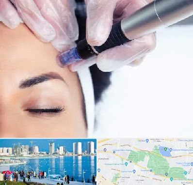 کلینیک مزوتراپی صورت در چیتگر 