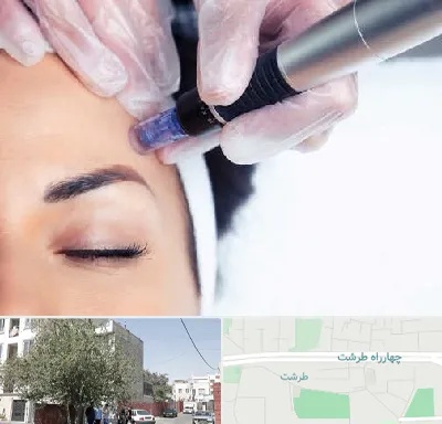 کلینیک مزوتراپی صورت در طرشت