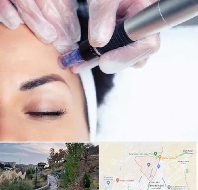 کلینیک مزوتراپی صورت در باغستان کرج