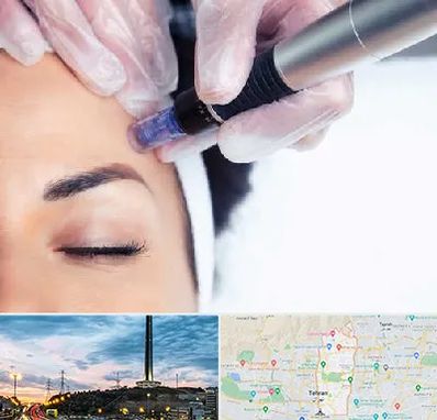 کلینیک مزوتراپی صورت در منطقه 2 تهران 