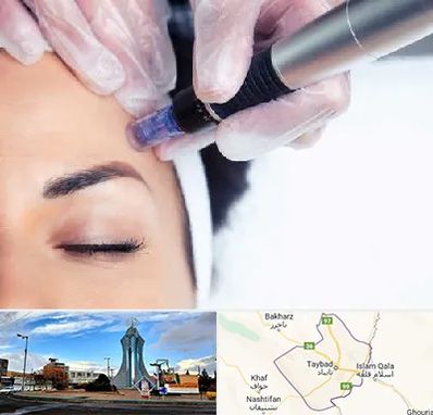 کلینیک مزوتراپی صورت در تایباد