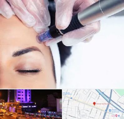 کلینیک مزوتراپی صورت در آبرسان تبریز