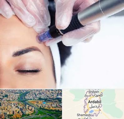 کلینیک مزوتراپی صورت در اردبیل