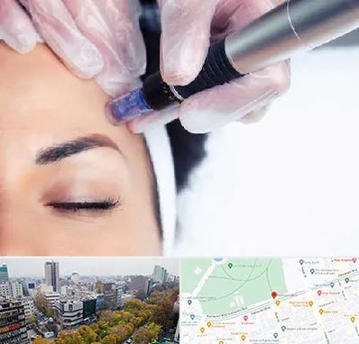 کلینیک مزوتراپی صورت در بلوار کشاورز 