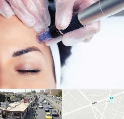 کلینیک مزوتراپی صورت در خیابان دماوند