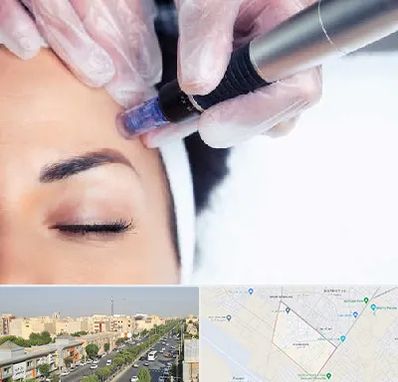 کلینیک مزوتراپی صورت در کیانمهر کرج