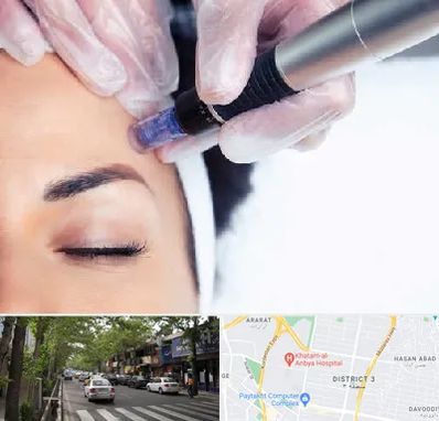 کلینیک مزوتراپی صورت در ظفر 