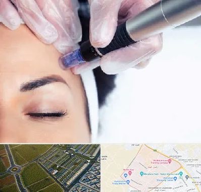 کلینیک مزوتراپی صورت در الهیه مشهد