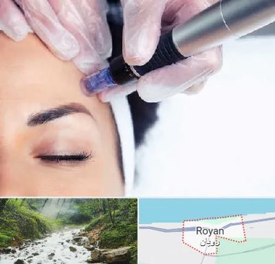 کلینیک مزوتراپی صورت در رویان